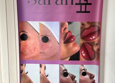 Banner at Aesthetixsbysarah Silkcorps Ltd in Wembley, England displaying beauty transformations.