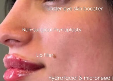 Close-up showcasing beauty treatments at Aesthetixsbysarah Silkcorps Ltd, Wembley, England, GB.
