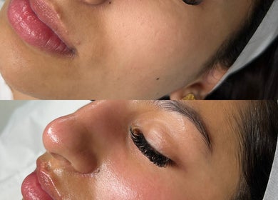 Before and after facial at Aesthetixsbysarah Silkcorps Ltd, Wembley, England, GB. Skin rejuvenated and lashes enhanced.