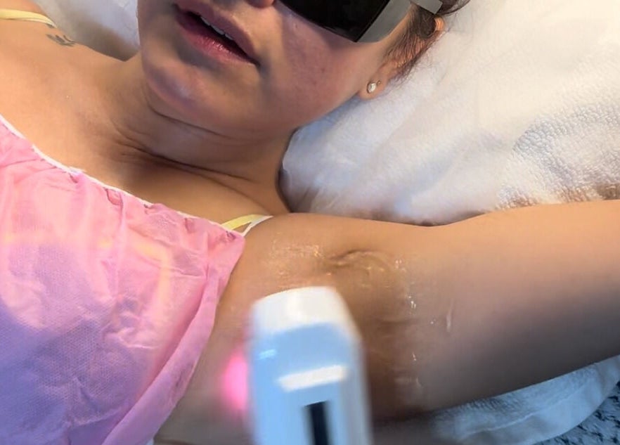 Laser treatment at Victoria aesthetic clinic in Rishon Lezion, Center District, IL.