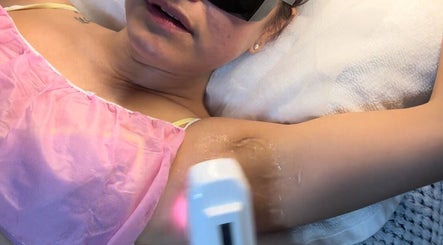 Laser treatment at Victoria aesthetic clinic in Rishon Lezion, Center District, IL.
