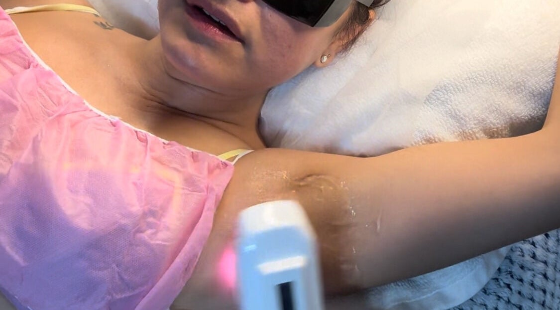 Laser treatment at Victoria aesthetic clinic in Rishon Lezion, Center District, IL.