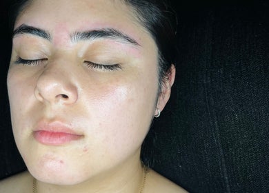 Rostro sereno después de tratamiento facial en MAR-YOU, Ciudad Santa Catarina, Nuevo León, MX.
