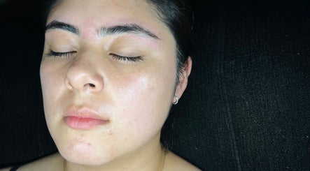 Rostro sereno después de tratamiento facial en MAR-YOU, Ciudad Santa Catarina, Nuevo León, MX.