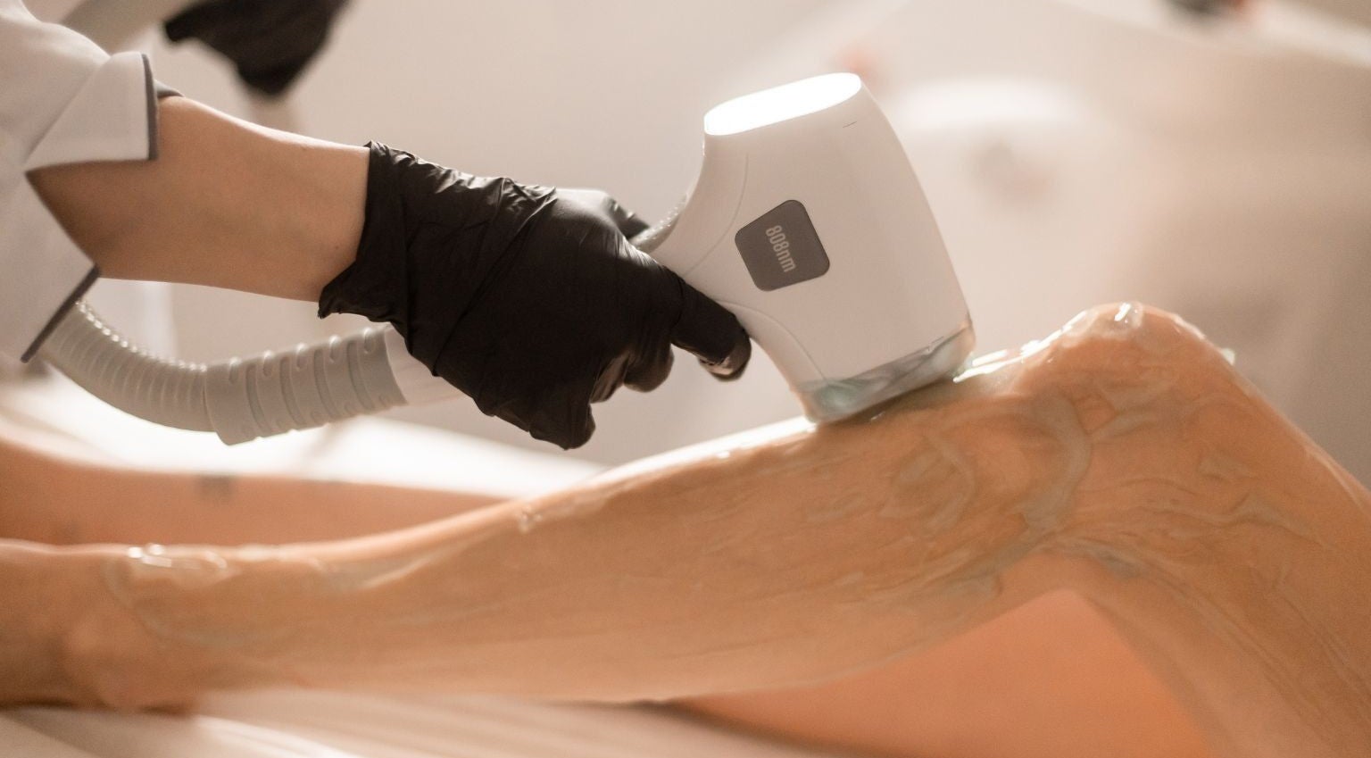 Laser hair removal treatment at Lāzer Klīnika Strēlnieku, Rīga, LV, enhancing smooth skin.