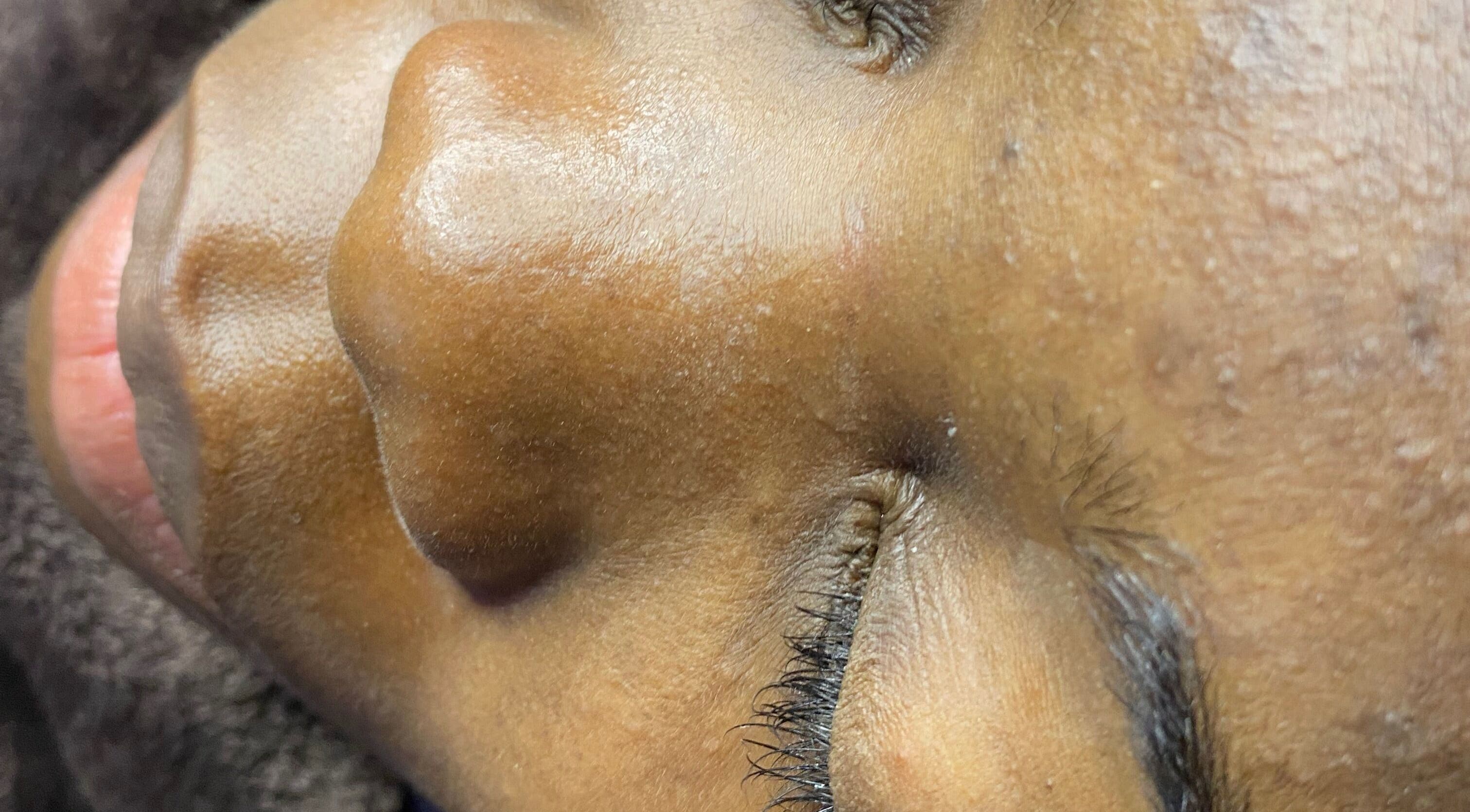 Close-up of a serene face receiving a treatment at Lash N Wax, Sandton, Gauteng, ZA.