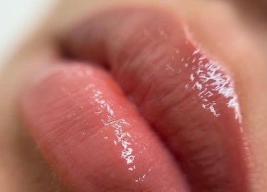 Labios con brillo en Kairós Clinic, Concepción, Bío Bío, CL, resaltando cuidados faciales.