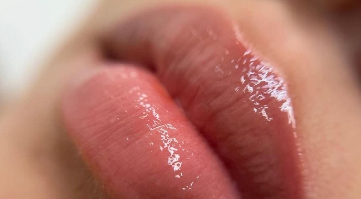 Labios con brillo en Kairós Clinic, Concepción, Bío Bío, CL, resaltando cuidados faciales.