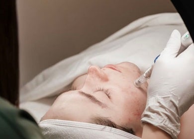 Tratamiento facial en Kairós Clinic, Concepción, Bío Bío, CL. Mejora la piel con cuidado experto.
