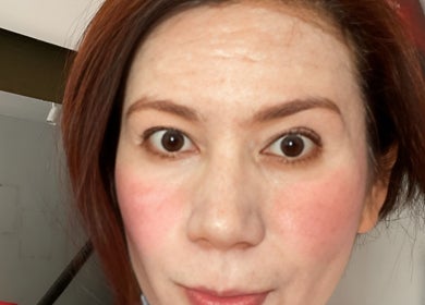 Close-up of a woman's radiant skin after treatment at Glazed Beauty Lounge Quezon City, Metro Manila, PH.