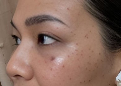 Close-up of radiant skin after treatment at Glazed Beauty Lounge, Antipolo City, Calabarzon, PH.