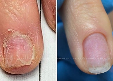 Before and after nail care at Shahz Nailz & Foot Clinique, Pointe-claire, Québec, CA.