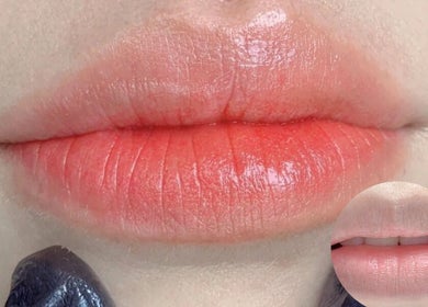 Close-up of enhanced lips after treatment at Gentle Cactus, Raffles Place, SG.