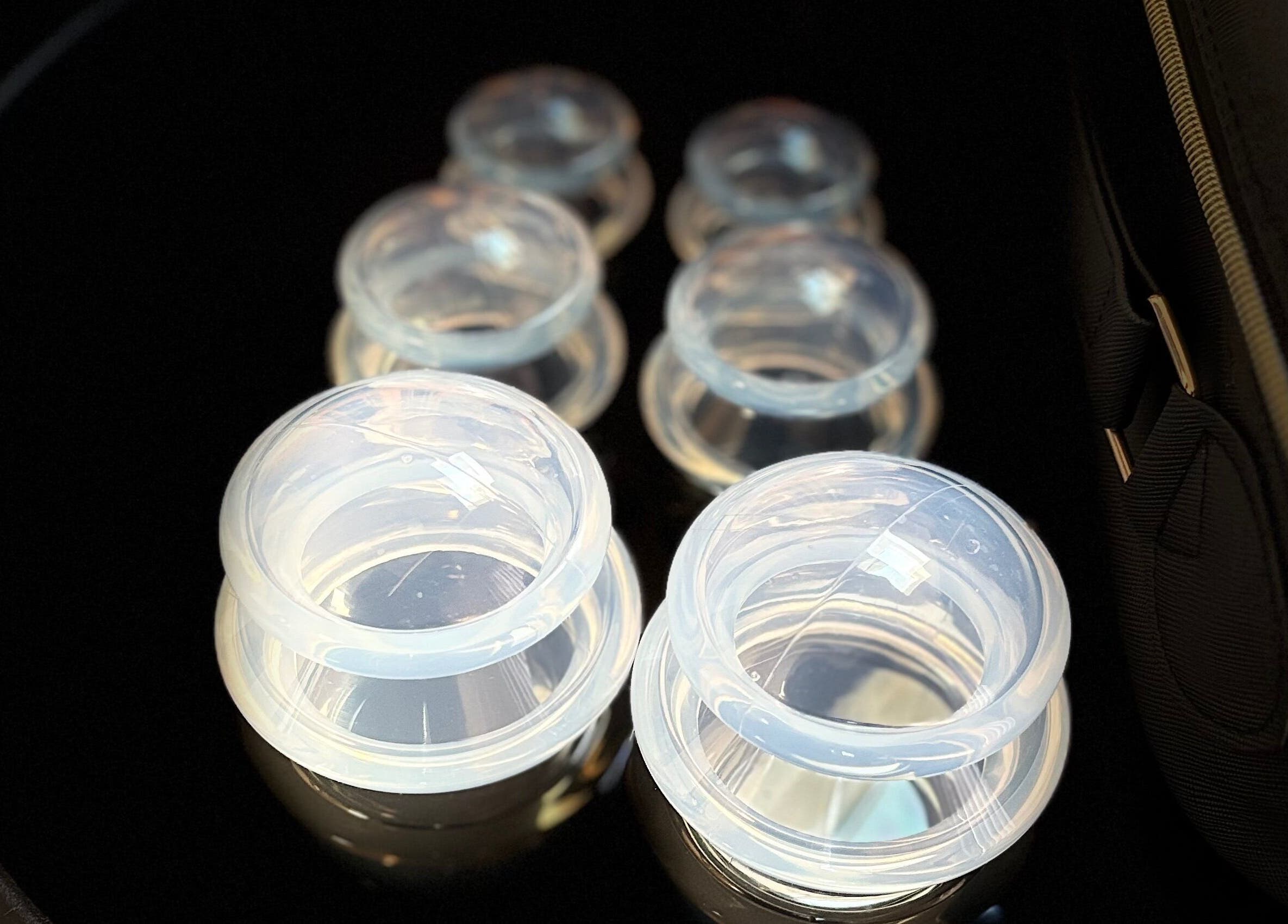 Close-up of cupping therapy tools at JSB Practices, Ilford, England, GB.