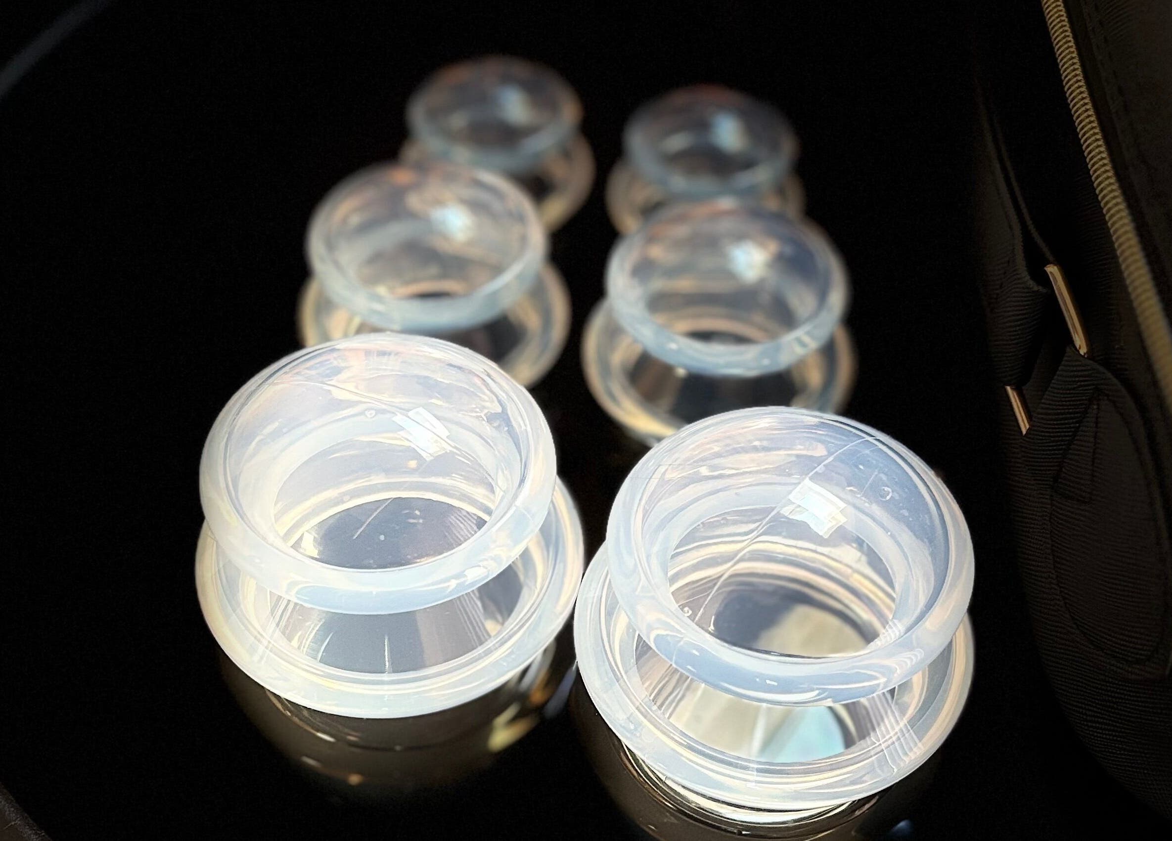 Cupping therapy tools at JSB Practices, Ilford, England, GB, enhance wellness treatments.