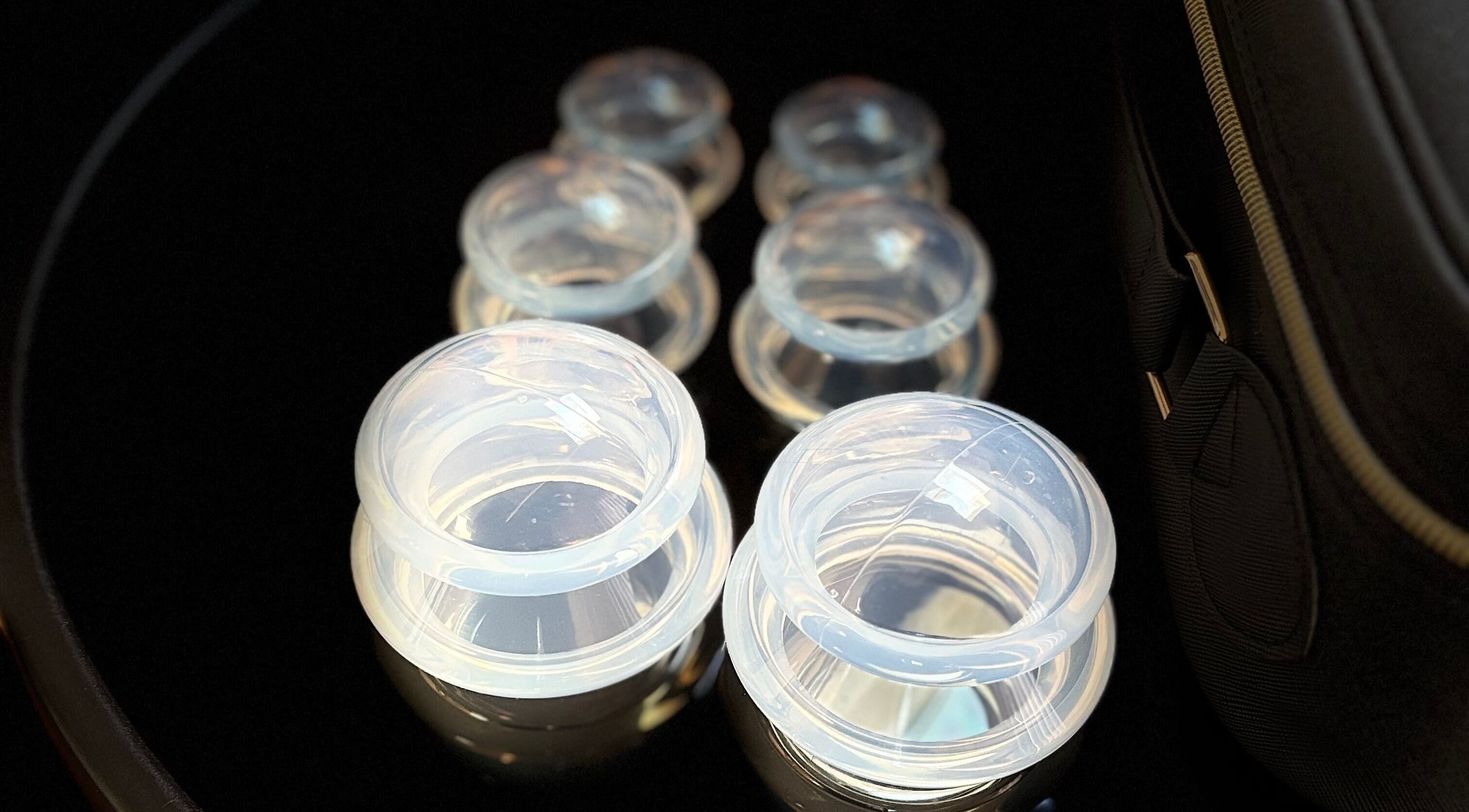 Cupping therapy tools at JSB Practices, Ilford, England, GB, enhance wellness treatments.