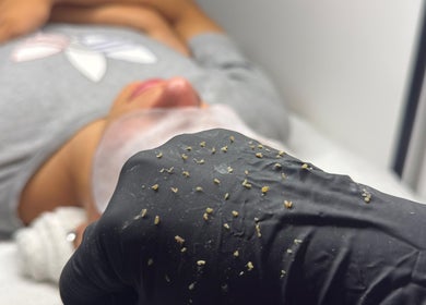Tratamiento facial de exfoliación en Atypical Skin Studio, Madrid, Comunidad De Madrid, ES.