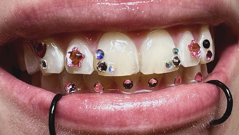 Zęby ozdobione kryształkami w Diamond Smile Kalisz, Kalisz, Województwo Wielkopolskie, PL.