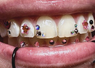 Zęby ozdobione kryształkami w Diamond Smile Kalisz, Kalisz, Województwo Wielkopolskie, PL.
