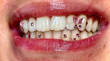Dekoracyjne kryształy na zębach w Diamond Smile Kalisz, Kalisz, Województwo Wielkopolskie, PL.