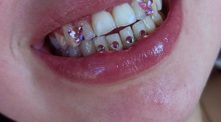 Dekoracje na zębach z kryształkami w Diamond Smile Kalisz, Kalisz, Województwo Wielkopolskie, PL.