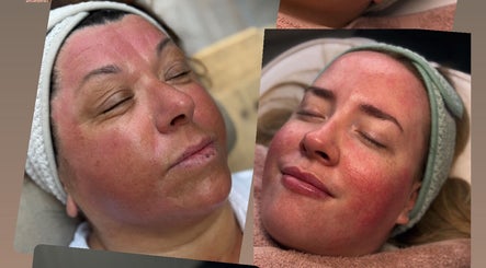 Rejuvenated faces after skincare treatment at Pure SKNN, Warrington, England, GB.