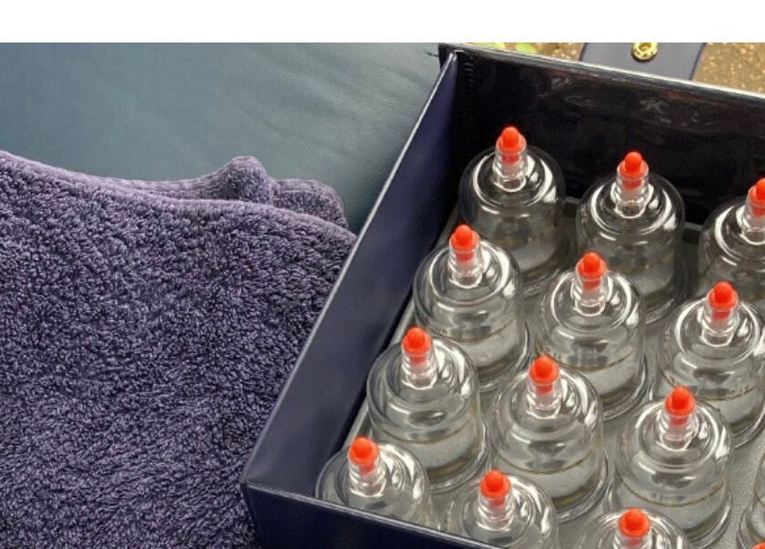 Cupping therapy set at LH Sport Therapy, Mumbles, Newton, Wales, GB with purple towel and oil bottle.