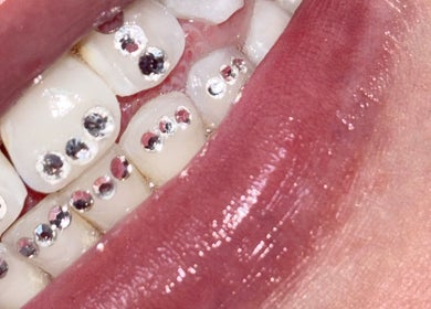 Close-up of sparkling teeth embellishments at Lashed By Audrey, Lisarow, New South Wales, AU.