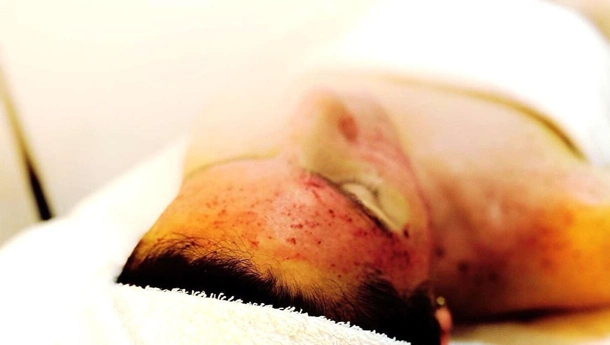 Ansiktsbehandling på Jac Ferrer wellness, Stockholm, Stockholms Län. Hudvård och avkoppling i fokus.