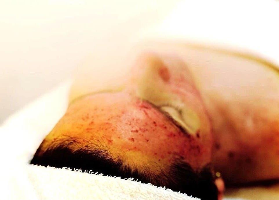 Ansiktsbehandling på Jac Ferrer wellness, Stockholm, Stockholms Län. Hudvård och avkoppling i fokus.