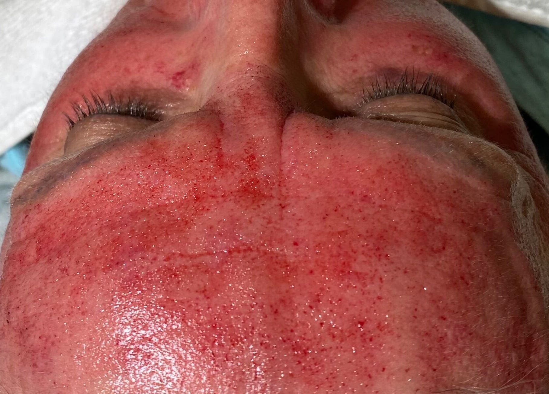 Hudbehandling på Jac Ferrer wellness i Stockholm, Stockholms Län, SE för förbättrad ansiktslyster.