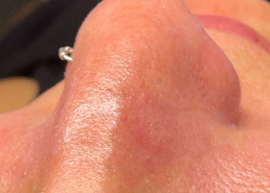 Close-up de pele brilhante após tratamento na Ferreira Knd em Chaves, Vila Real, PT.