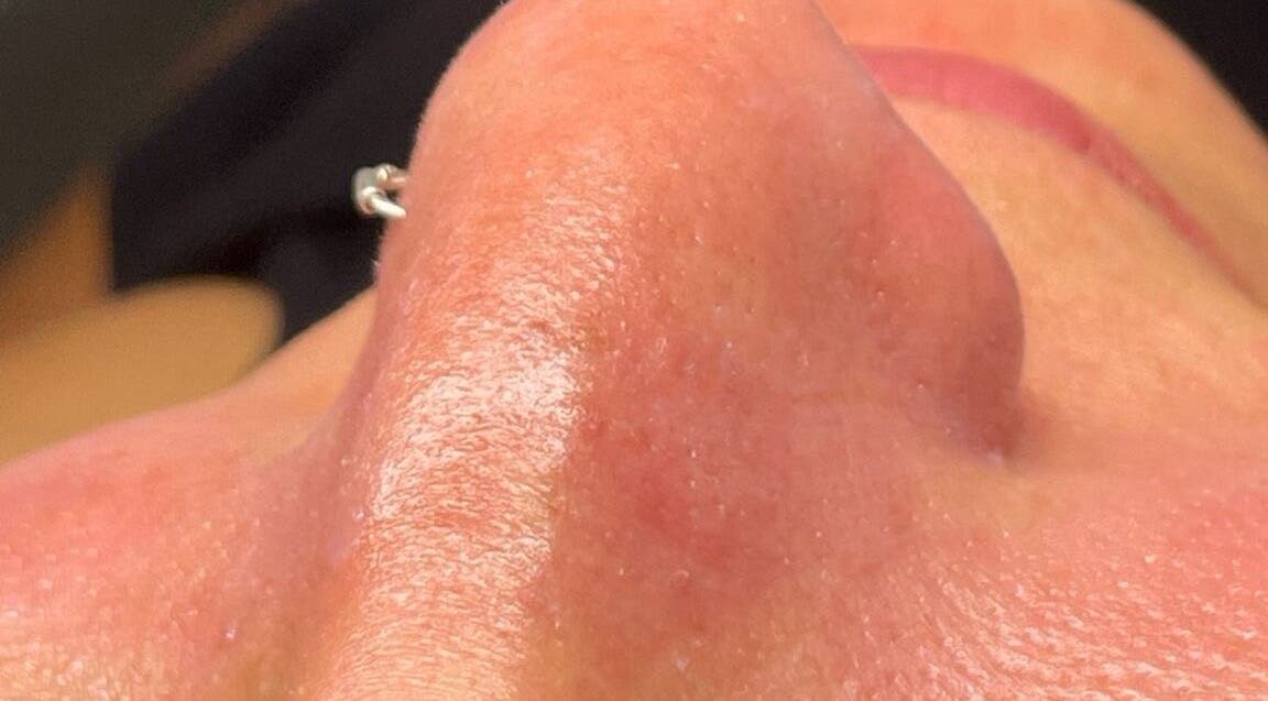 Close-up de pele brilhante após tratamento na Ferreira Knd em Chaves, Vila Real, PT.