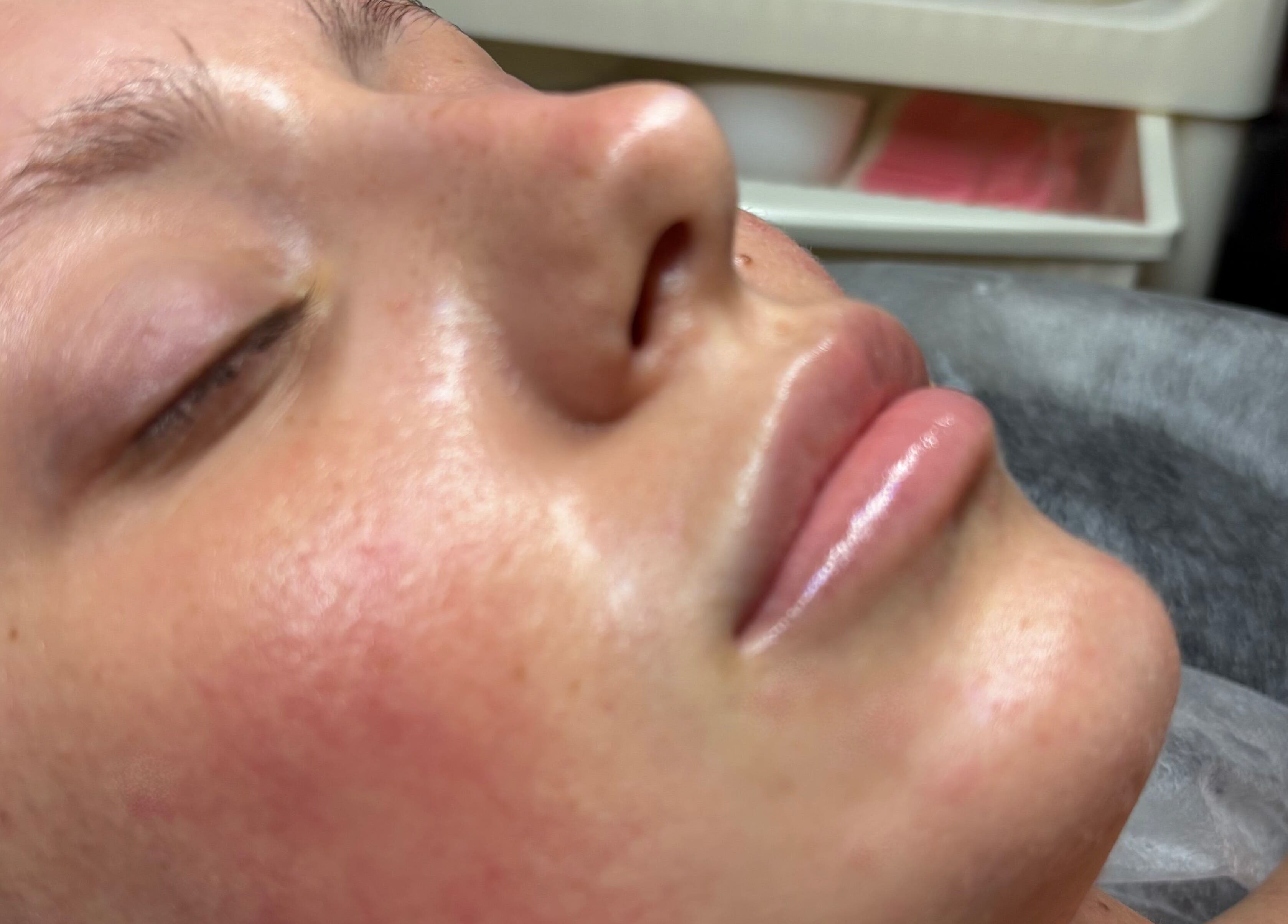 Close-up of a person with visibly smooth skin after a facial at TheClarkeComplextion, Plymouth, England, GB.