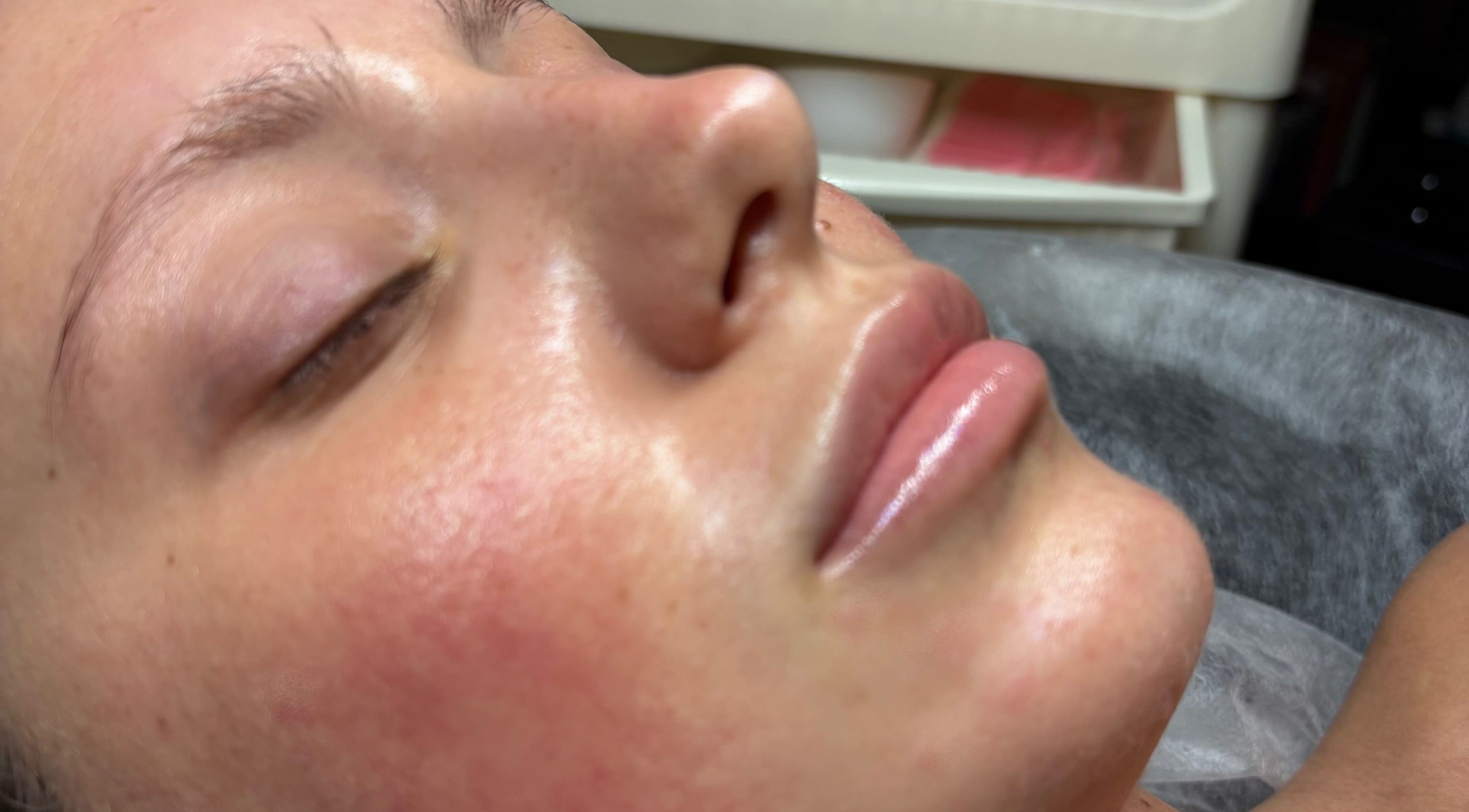 Close-up of a person with visibly smooth skin after a facial at TheClarkeComplextion, Plymouth, England, GB.