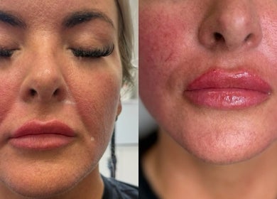 Close-up of facial treatments at Rumours Aesthetics, Clonmel, County Tipperary, IE for radiant skin results.