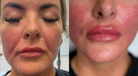 Close-up of facial treatments at Rumours Aesthetics, Clonmel, County Tipperary, IE for radiant skin results.