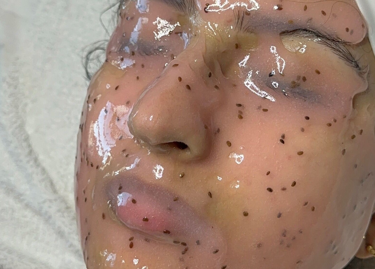 Client receiving cleansing facial at Eternal Medspa, Halton Hills, Ontario, CA for glowing skin.