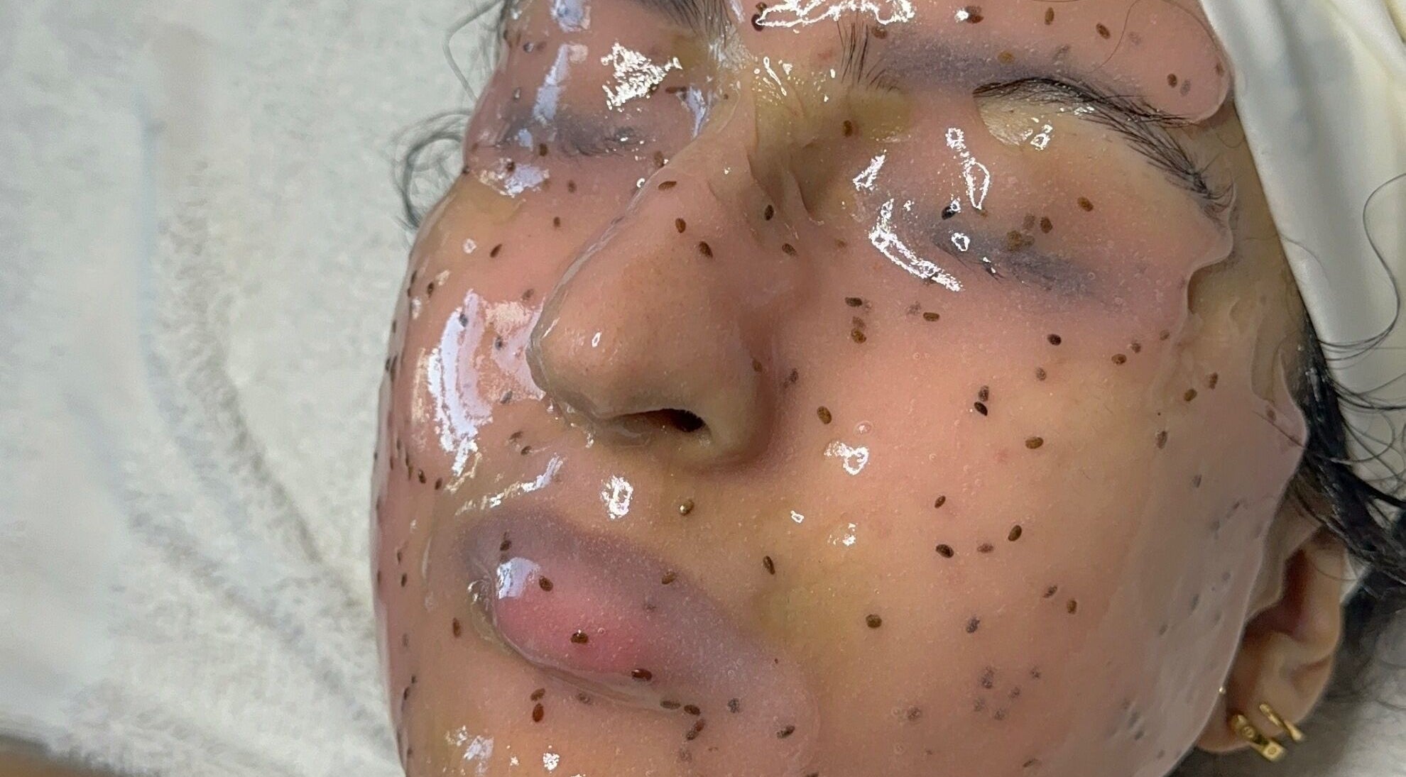 Client receiving cleansing facial at Eternal Medspa, Halton Hills, Ontario, CA for glowing skin.