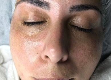 Close-up of a relaxed face pre-treatment at Beauty by Angie, Raħal Ġdid, MT.