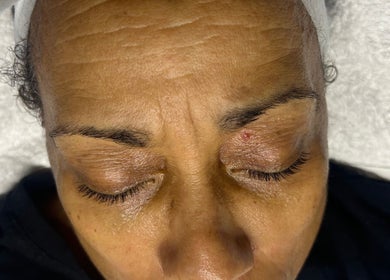 Client relaxing at Luxe Mere’, London, England, GB, during a rejuvenating facial treatment.