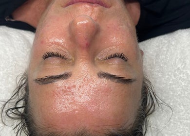 Refreshing facial glow from Luxe Mere’ in London, England, GB. Experience ultimate relaxation and rejuvenation.