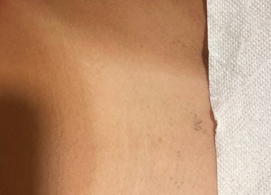 Sessão de cuidado de pele em JL CLINIC PORTO, Matosinhos, Porto, PT, destacando a suavidade da pele.
