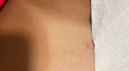 Sessão de cuidado de pele em JL CLINIC PORTO, Matosinhos, Porto, PT, destacando a suavidade da pele.