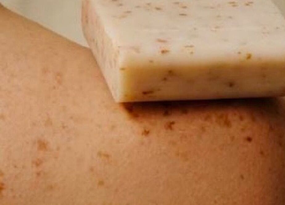 Exfoliating soap on skin at SKINCLINIC.MT, Sliema / Is-Swieqi, MT for gentle treatment.