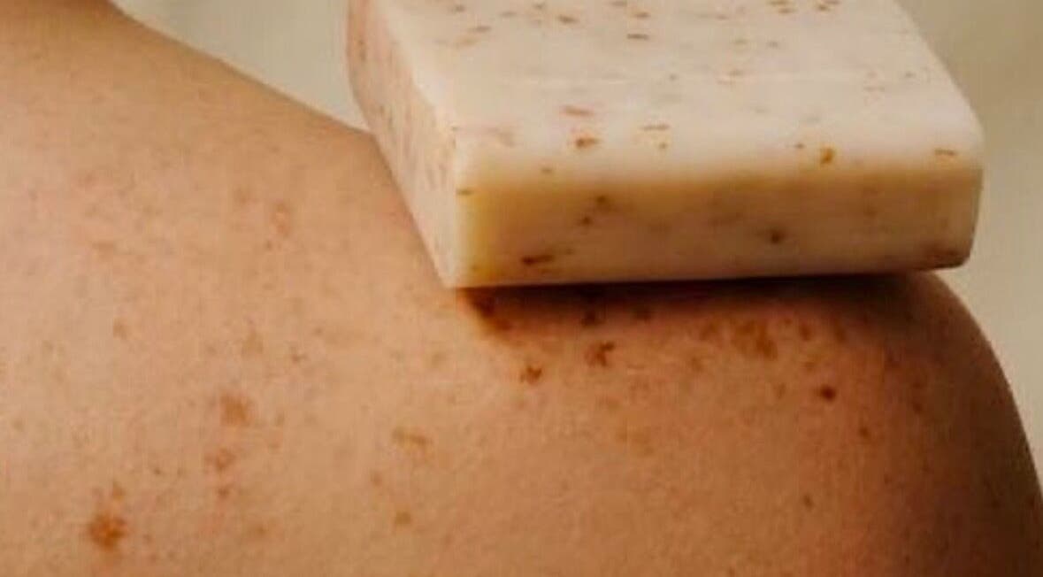 Exfoliating soap on skin at SKINCLINIC.MT, Sliema / Is-Swieqi, MT for gentle treatment.