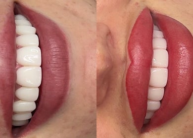 Close-up of vibrant lips before and after treatment at Tabitha Tweaks, Skelmersdale, England, GB.