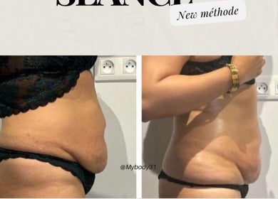 Avant et après transformation chez Mybody31, Toulouse, Occitanie, FR. Résultats efficaces de la nouvelle méthode.