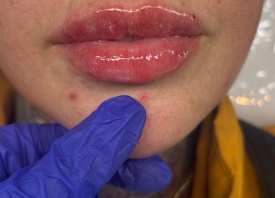 Close-up of glossy lips with skincare treatment at Filledbyjenx in Urmston, England, GB.