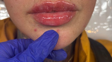 Close-up of glossy lips with skincare treatment at Filledbyjenx in Urmston, England, GB.